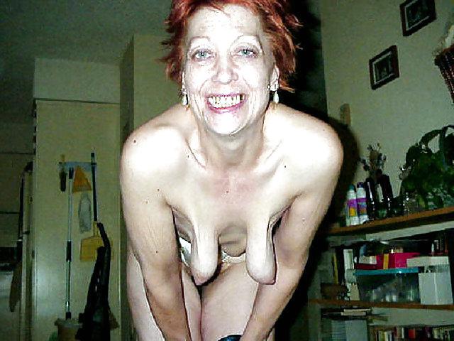 22P Other saggy