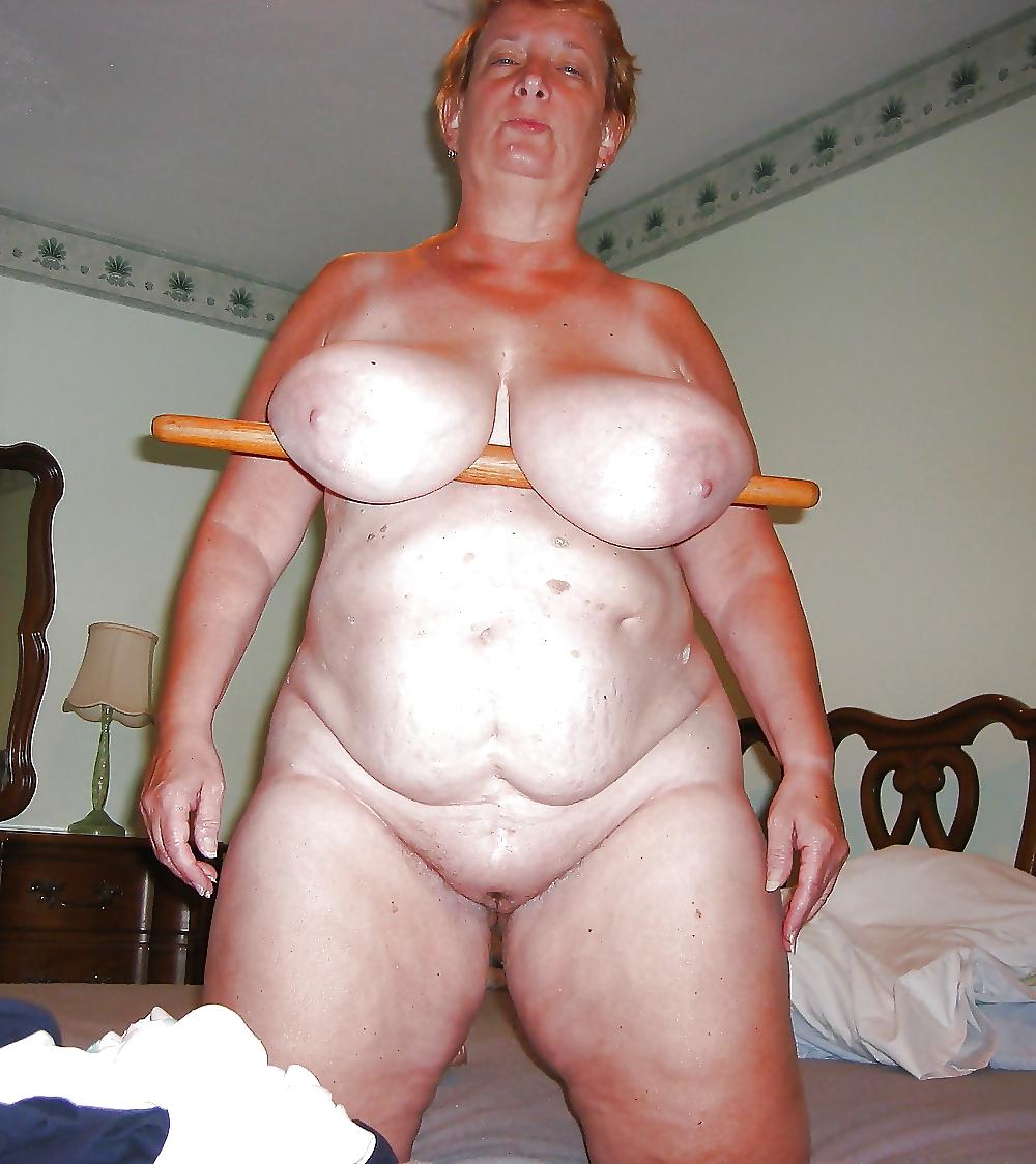 25P Stretch Marks, Scars and Saggy 27