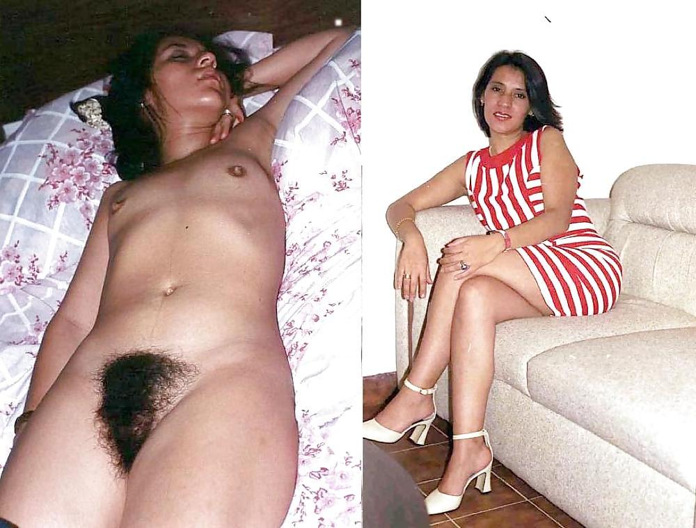 20P Dressed - Undressed Hairy Women Part 4