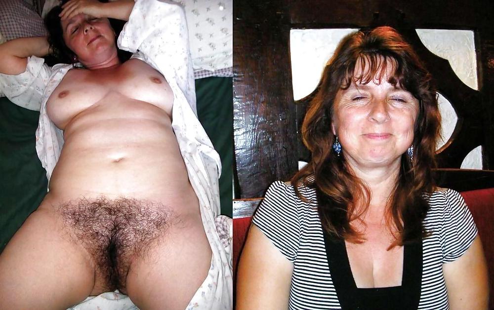 20P Dressed - Undressed Hairy Women Part 4