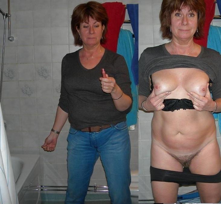 20P Dressed - Undressed Hairy Women Part 4