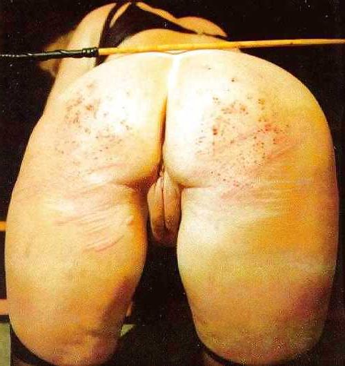 25P Spanking Marks