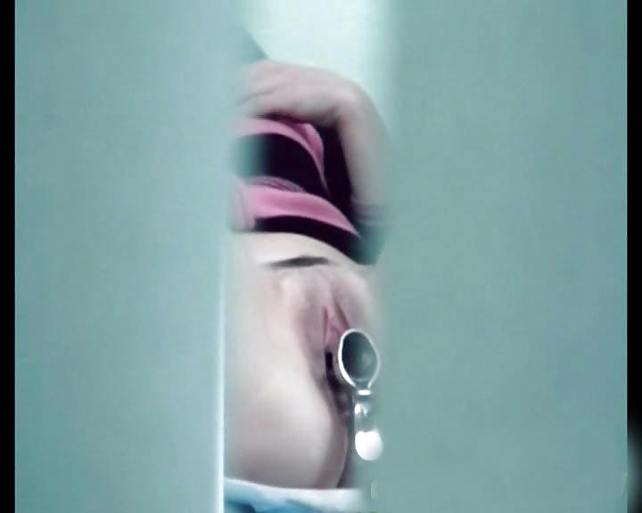 25P Gyno spypics