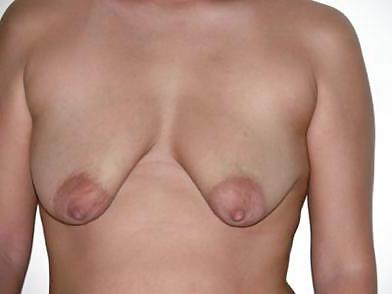 20P Small empty saggy breasts 5
