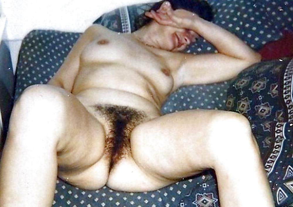 25P Hairy amateurs
