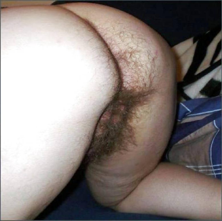 20P Hairy ass