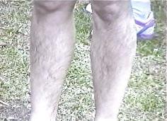 14P Women with hairy legs