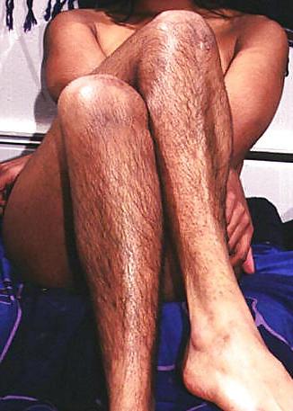 14P Women with hairy legs