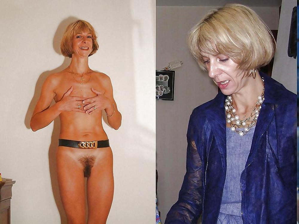 25P Dressed Undressed Hairy 