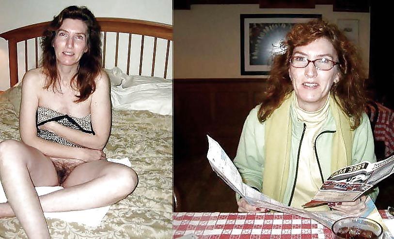 25P Dressed undressed hairy 3