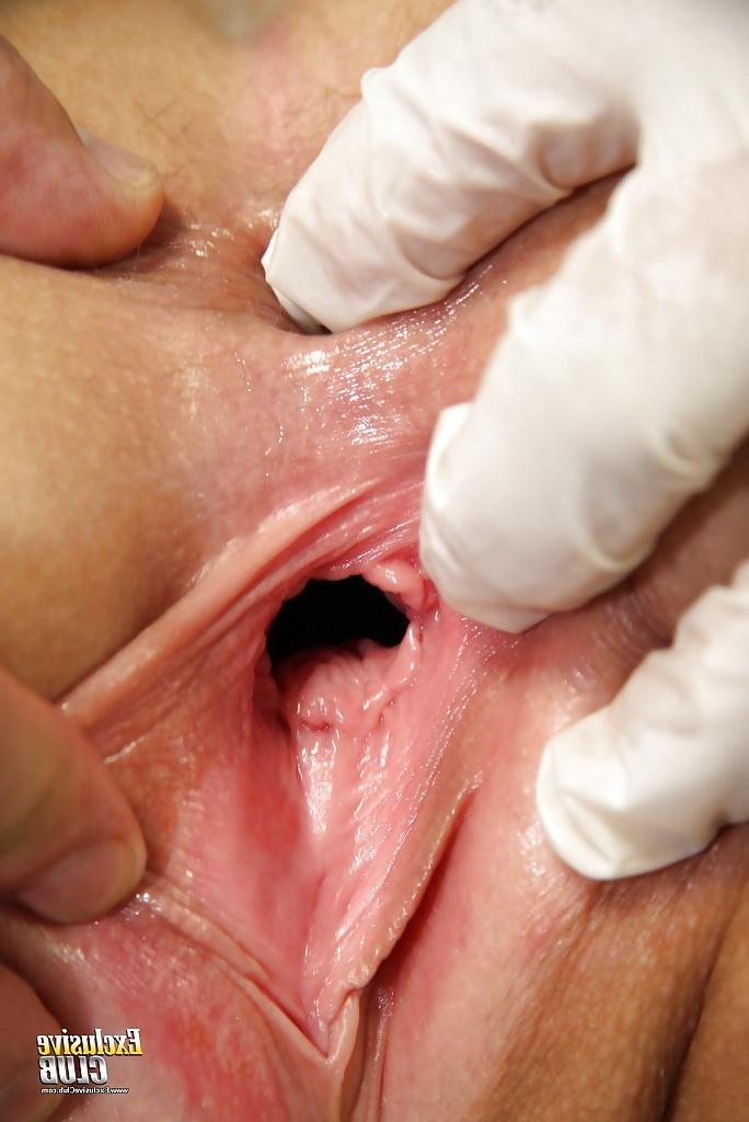 16P Gyno tits of the smoking hot pornstar Alexa Bold are teased by her doc