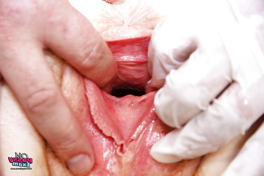 16P Mature gal's visit to the gyno gets up close &amp; hairy with spread pussy
