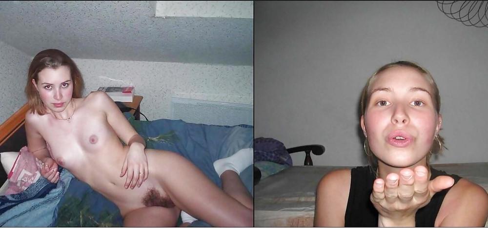 25P Dressed - Undressed Hairy Women Part 16