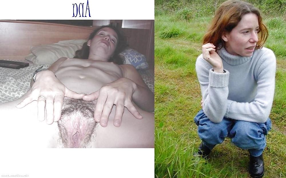 25P Dressed - Undressed Hairy Women Part 16