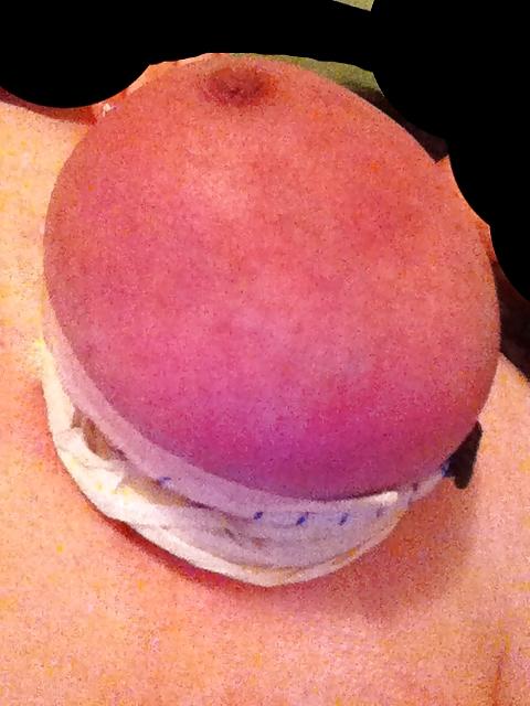 21P Tied clothes pinned and wax covered 
