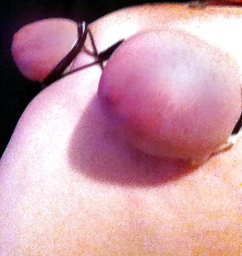 21P Tied clothes pinned and wax covered 
