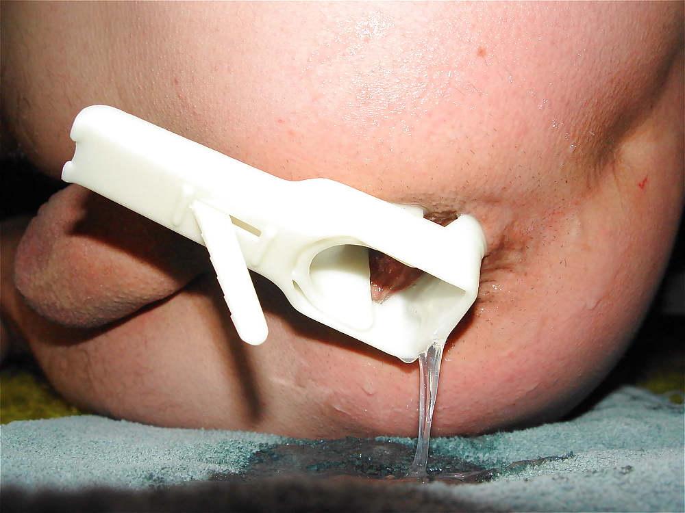 22P Gyno stretch