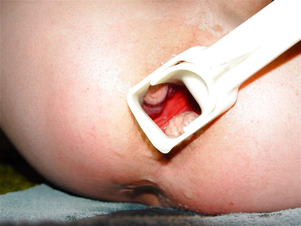 22P Gyno stretch