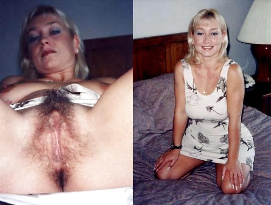 25P Dressed - Undressed Hairy women Part 17