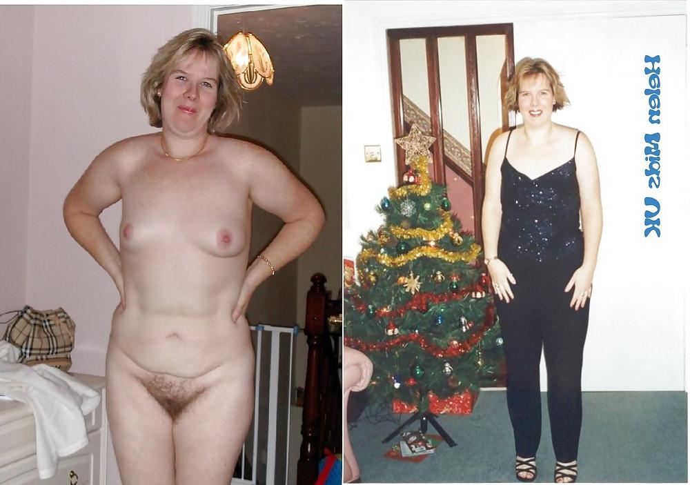 25P Dressed - Undressed Hairy women Part 17