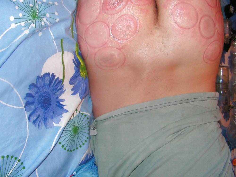 18P BDSM fire cups on ass