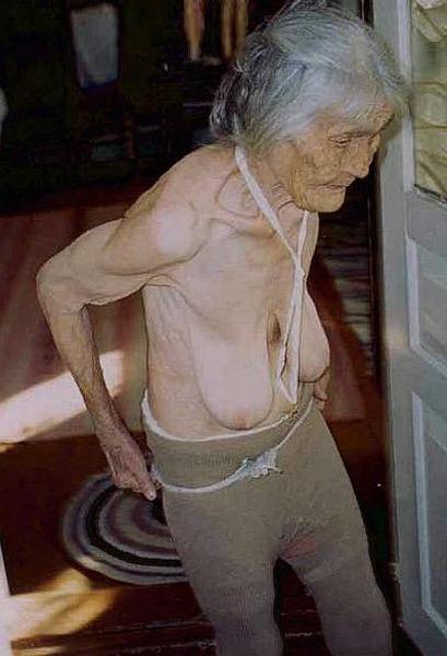 15P old women with big saggy wrinkly boobs