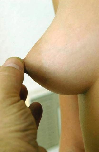 15P Breast exam in gyno hospital