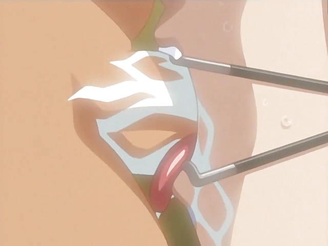 25P Hentai BDSM