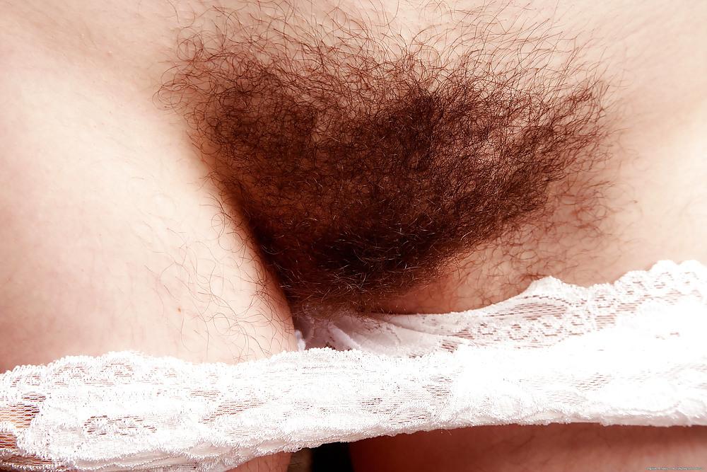 25P More Hairy Teen Urtica