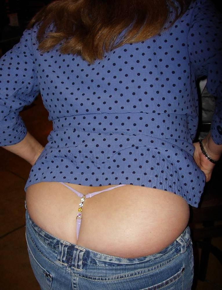 10P Whaletail