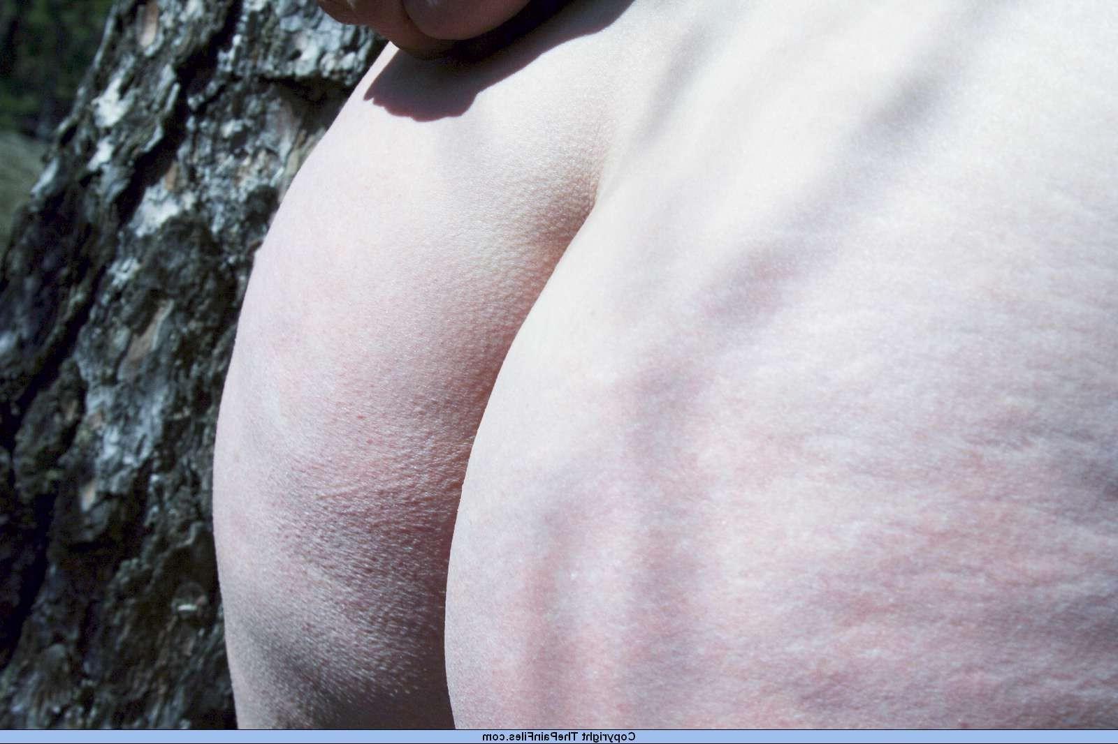 16P Busty amateur sub in bdsm breast play out in the woods