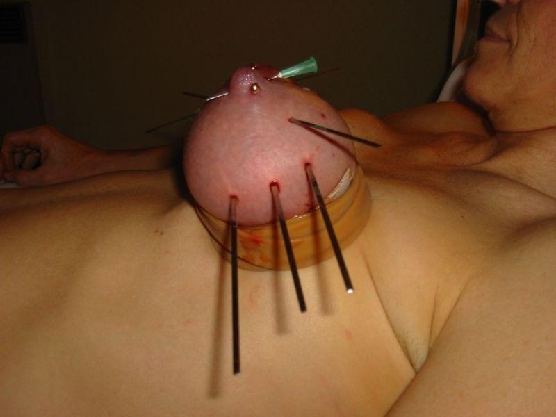 18P extremely tortured and bondaged boobs