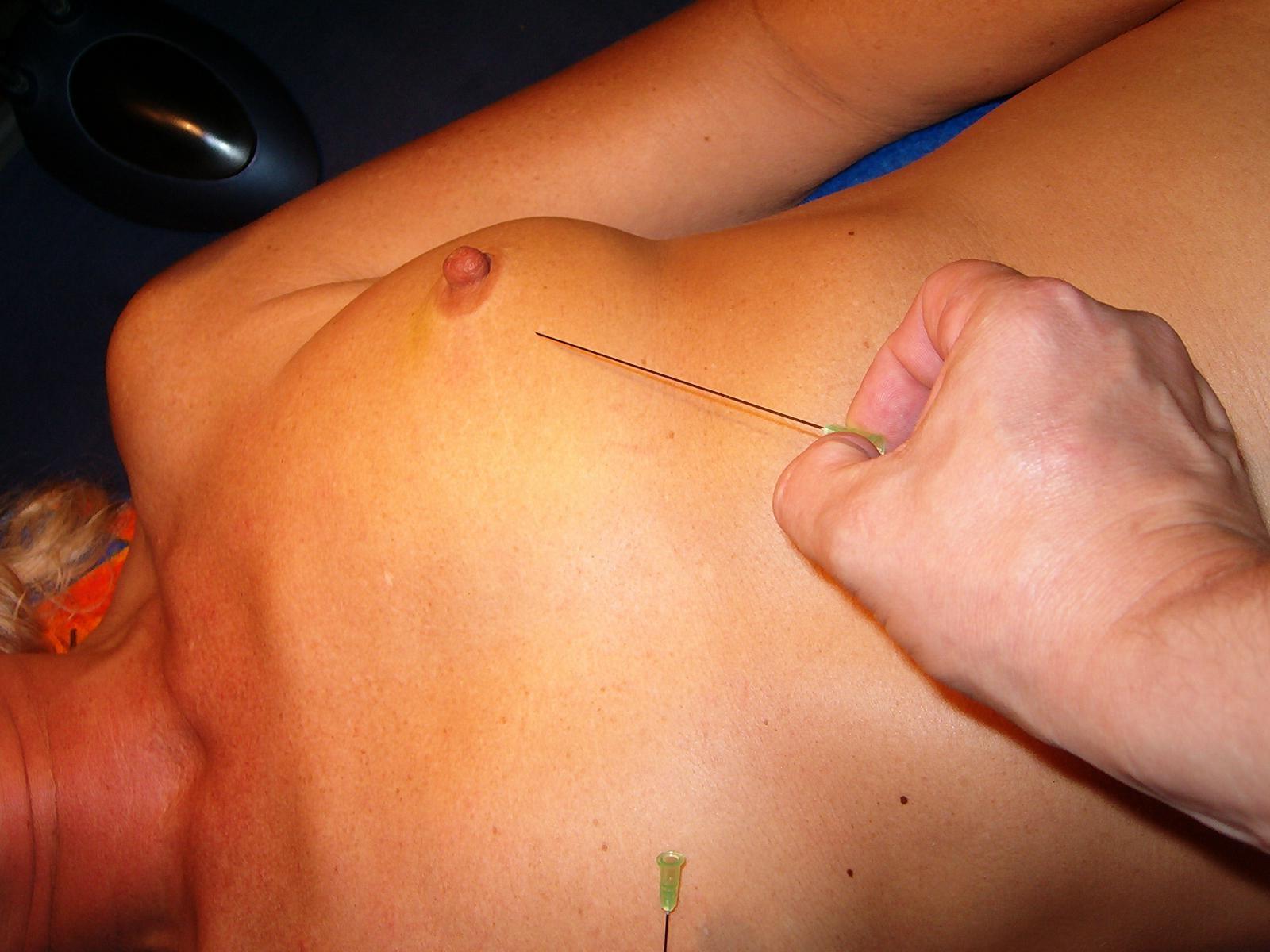 16P Extreme needle bdsm and mature german slavery pain
