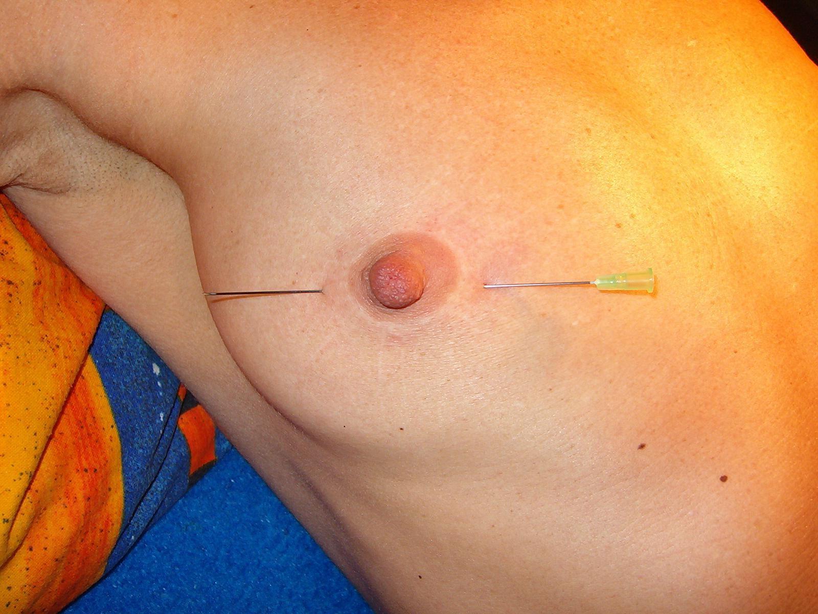 16P Extreme needle bdsm and mature german slavery pain