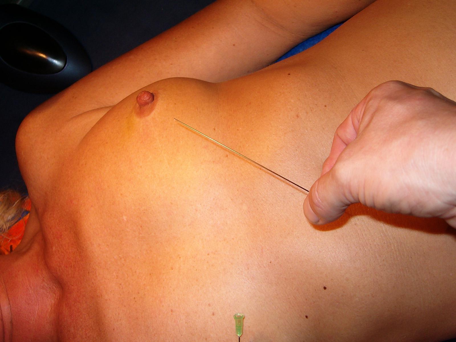 16P Extreme needle bdsm and mature german slavery pain
