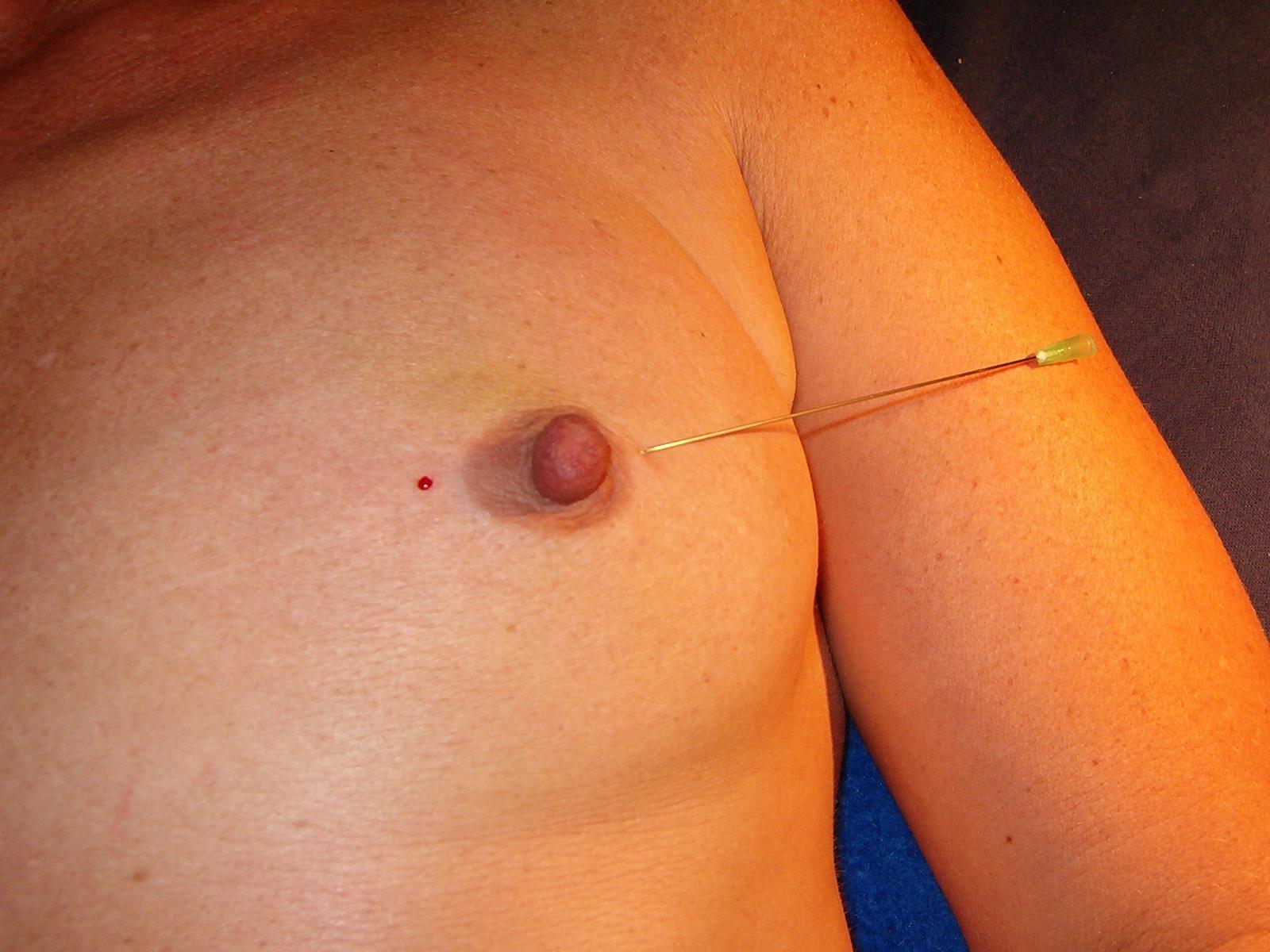 16P Mature needle torture and breast skewering punishment of german slavegirl Tri