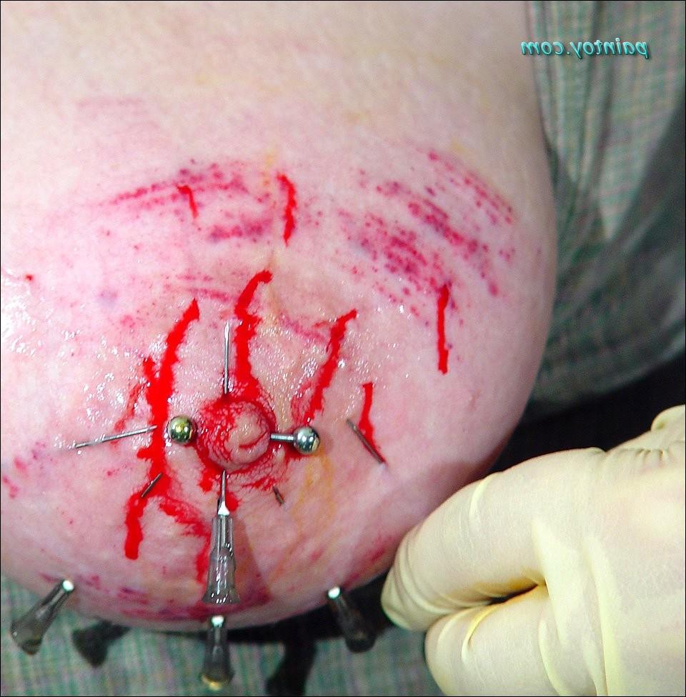 20P Extreme bdsm pins and needles treatment