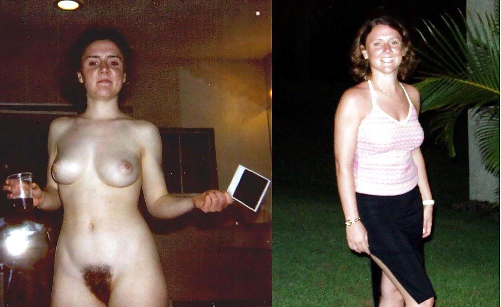 25P Dressed - Undressed Hairy Women Part 19
