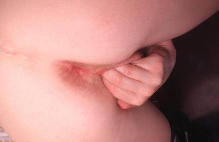 15P Slutty redhead fisting sorry pussy