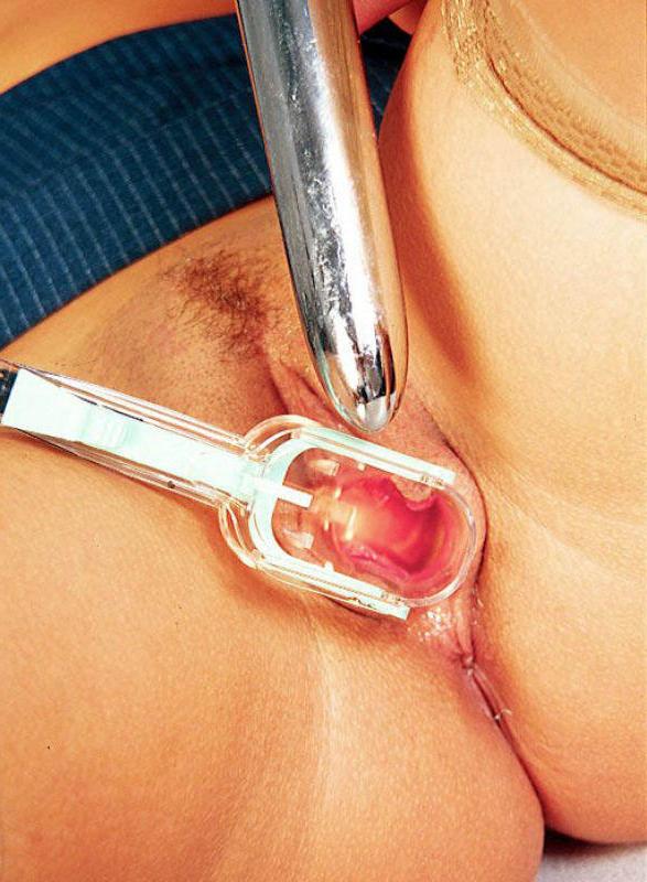15P Horny secretary doing speculum exam