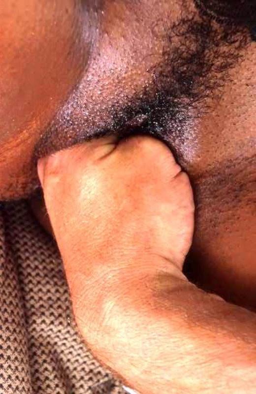 20P Ebony gal with massive tits fisting