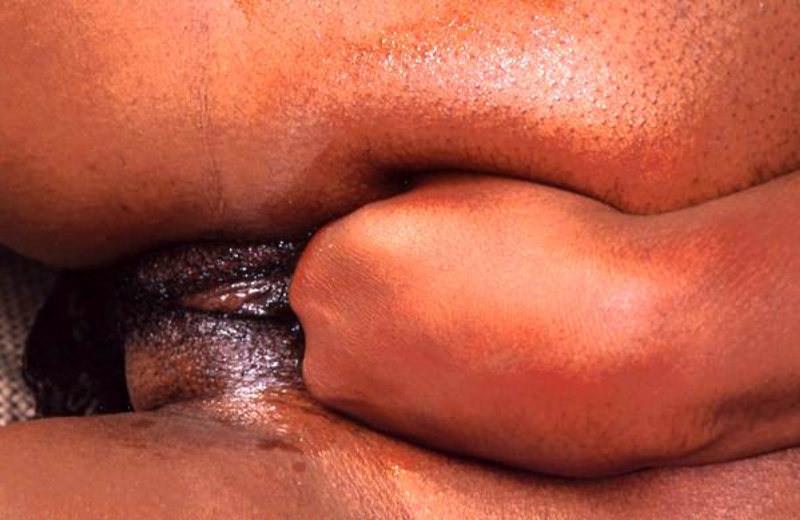 20P Ebony gal with massive tits fisting