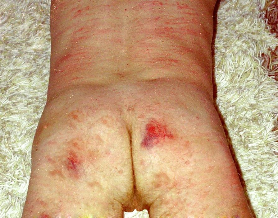 14P TgAbigail's whipping