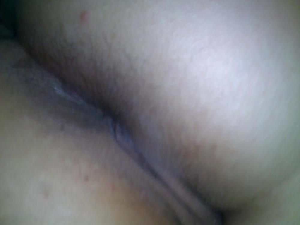 25P Dhm