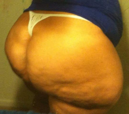 20P White asses matters