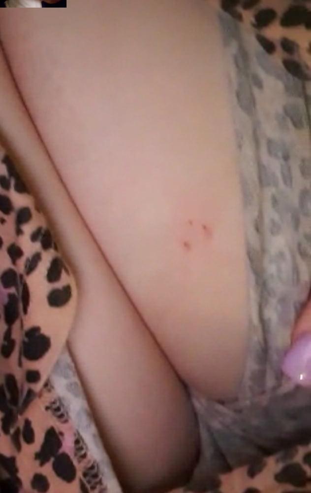 8P My dares nude