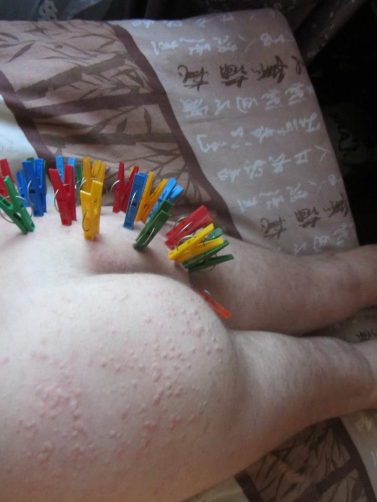 25P marks after bdsm