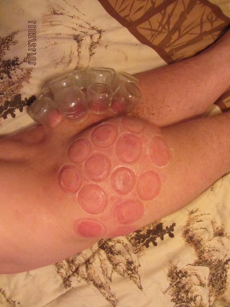 25P marks after bdsm
