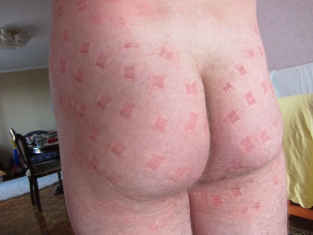 25P marks after bdsm