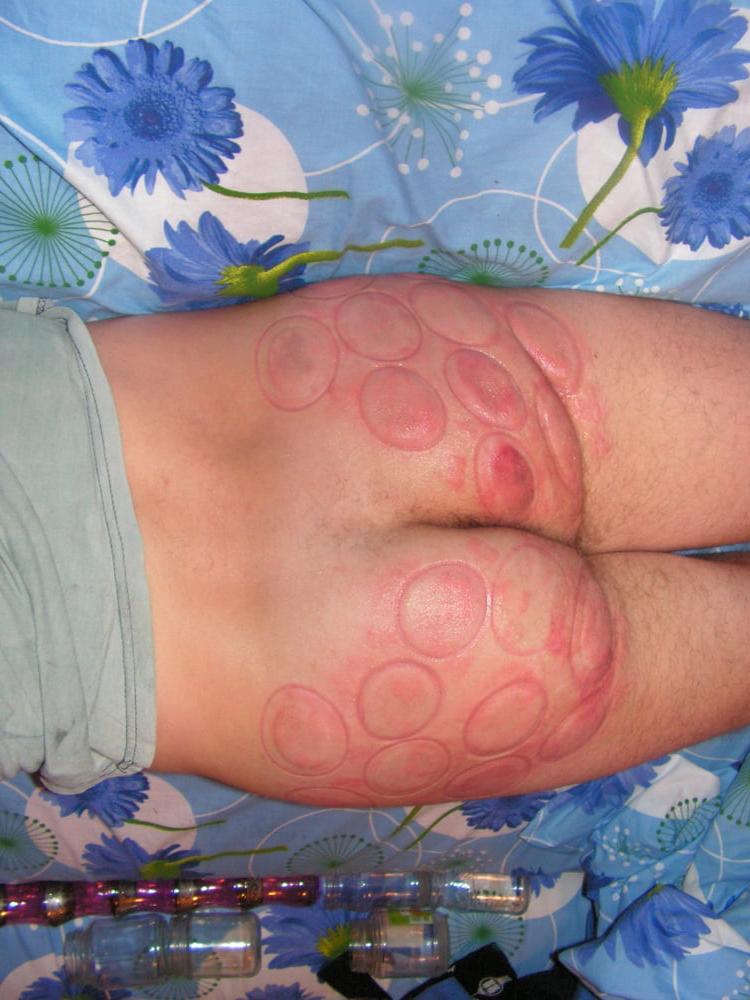 25P marks after bdsm